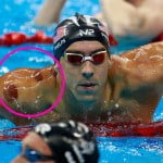 Berkeley Accupunture Phelps with cupping marks