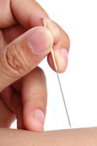 acupuncturist in Berkeley with an acupuncture needle to help with fertility, IVF and chronic pain