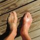 Acupuncture can treat gout along with Chinese Medicine. Contact Tao to Wellness in Berkeley for treating gout with acupuncture and herbs.