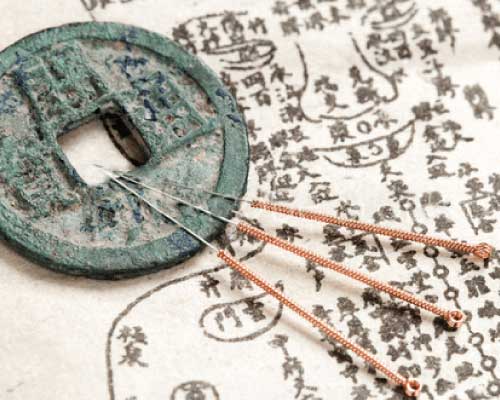 Berkeley Accupunture Treatment With Needle
